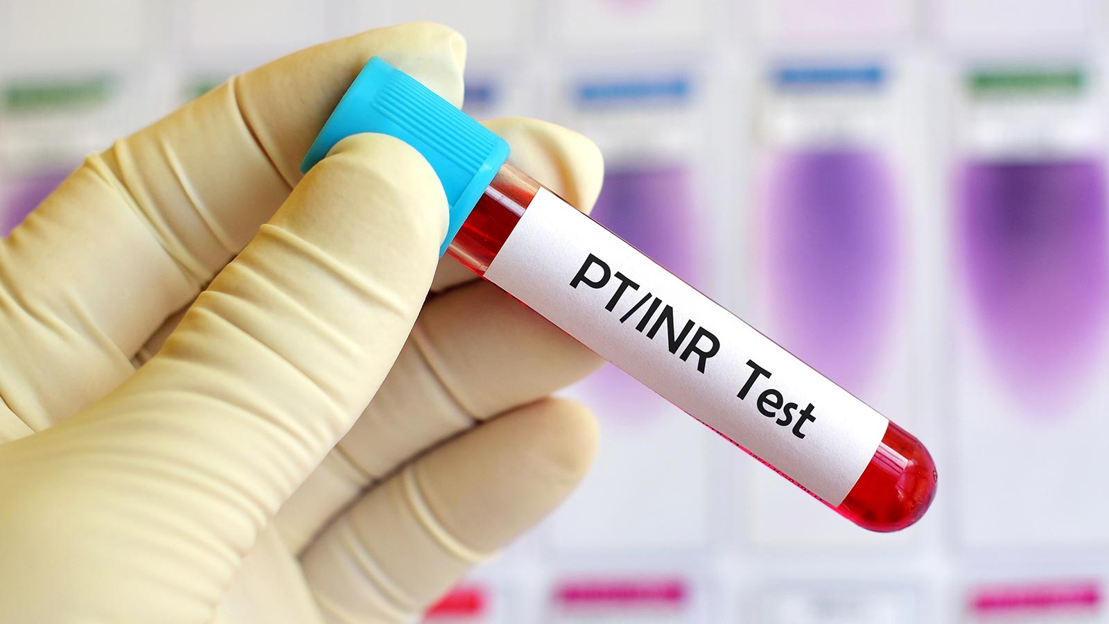 dabigatrán prometedor